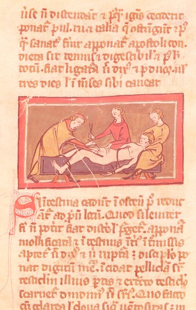 Ms H 89 fol. 23 Chirurgie, z vydání Knihy chirurgie od Rogiera de Salerne od French School