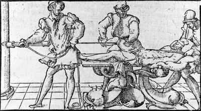 Redukce dislokace, -v „Lékařské smlouvě Ambroise Paré“, kolem roku 1560. od French School