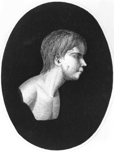 Victor of Aveyron, přední díl De lEducation dun homme sauvage od J.E.Itarda od French School
