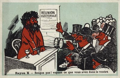 Rentgenové záření - Nehýbejte se! Uvidíme, co má v žaludku od French School