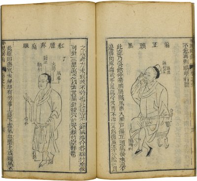 Shen Shi Yao Han Vzácná kniha oftalmologie, 1644 od Fu Renyu