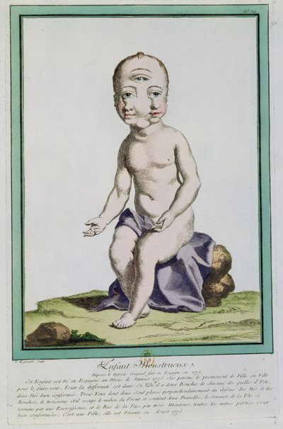 Dítě s deformovanou hlavou, z „Les Ecarts de la Nature“, Paříž, 1775 od Genevieve Regnault de Nangis