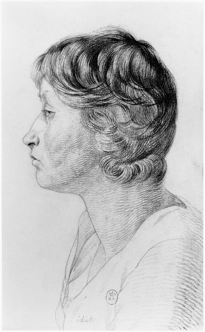 Idiot, ilustrace z nepublikovaného pojednání Jean Etienne Dominique Esquirol (1772-1840) o šílencích z blázince Salpetriere, kolem roku 1818 od Georges Francois Gabriel