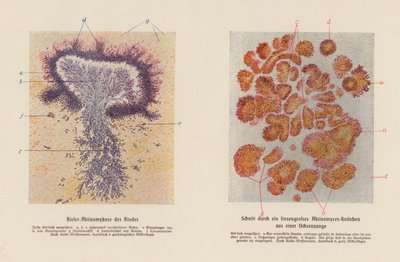 Actinomyces bovis (barevná litografie) od German School