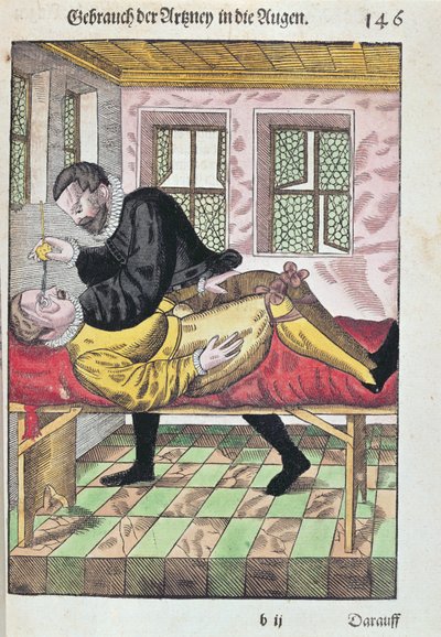 Operace očí, z Ophthalmodouleia od Georga Bartische (1535-1636), vydaná v Drážďanech v roce 1583 (barevný dřevořez) od German School
