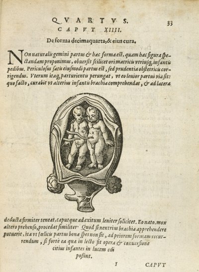 Neidentická dvojčata v lůně, ilustrace z kapitoly 14, kniha 4 knihy O početí a růstu člověka od Rueff, 1587 od German School