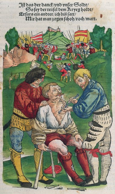 Odstranění šípu, ilustrace z Feldtbuch der Wundartzney od Hanse von Gersdorffa, 1540 od German School