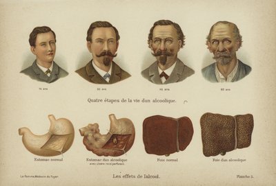 Účinky zneužívání alkoholu (color litho) od German School