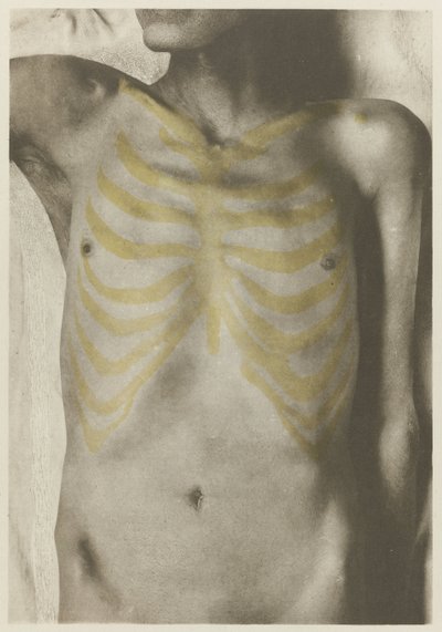 Anatomické foto van een mannelijk lijk: 