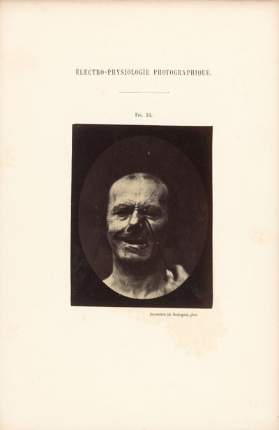 Fotografická elektrofyziologie, obrázek 53 od Guillaume Benjamin Duchenne