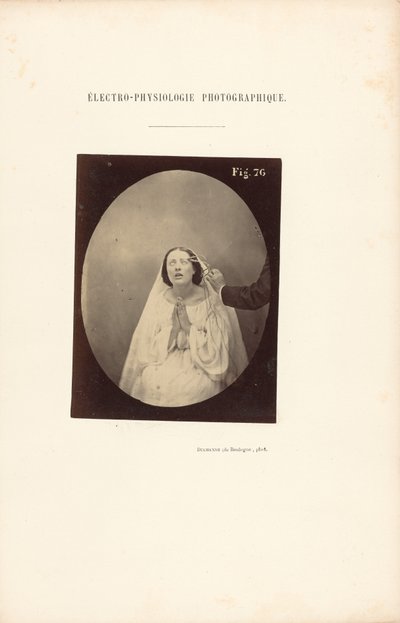Fotografická elektrofyziologie, obrázek 76 od Guillaume Benjamin Duchenne