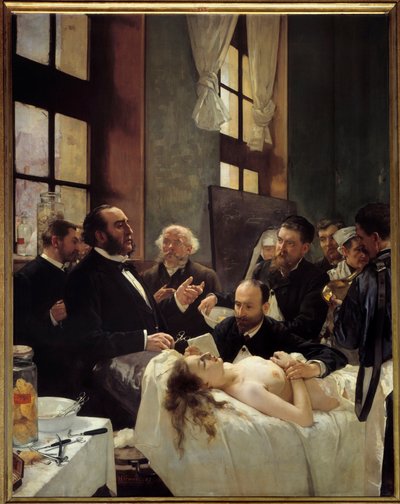 Dr. Jules Emile (Jules-Emile) Pean (1830-1898) vyučující v nemocnici Saint Louis svůj objev skřípnutí lodí aneb „Před operací“ Obraz Henriho Gervexe (1852-1929) 1887 Sun. 2,42x1,88 m Paříž, musee d