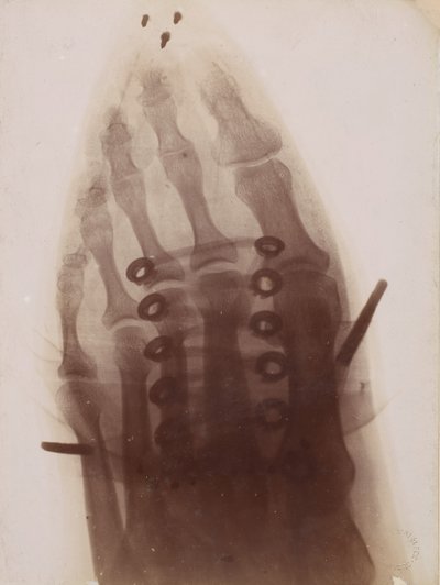Noha skrz botu, 1896. od Henri van Heurck