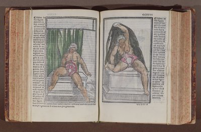 Ženská anatomie, z komentářů k světové anatomii s nejvelkolepějšími doplňky, Jacopo Berengario da Carpi (asi 1460-asi 1530), publikovaná v Bologni, 1521 (barevný dřevořez) od Italian School