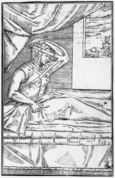 Rekonstrukční chirurgie na nose, ilustrace z De curtorum chirurgia per insitionem od Gaspare Tagliacozziho (1545-99) Benátky, vydáno 1597 od Italian School