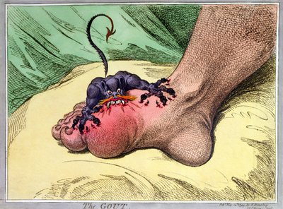 The Gout, vydané Hannah Humphrey v roce 1799 (ručně kolorovaný měkký lept) od James Gillray