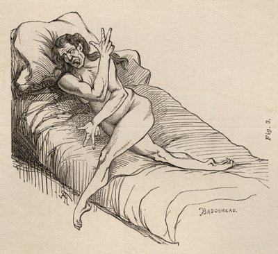 Hysterická epilepsie, záchvat, zkroucení, obr. 3 z „Iconographie Photographique de La Salpetriere“ od Bourneville et P. Regnard, Paříž, 1876 od Jean Francois Badoureau
