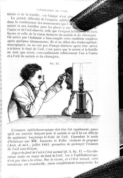 Ilustrace z "Traite Pratique des Maladies des Yeux", překladu "A Manual on the Principles and Practice of Ophthalmic Medicine and Surgery", Thomas Wharton Jones (1808-91), vydal E. Foucher, Paříž 1862 (rytina) (čb foto) od Jean Francois Badoureau