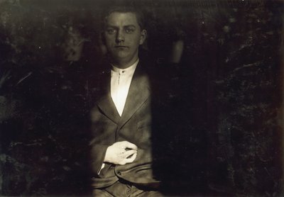 Frank Wiegel z Brooklynu, zraněný po 18 hodinách práce denně v 15 letech, dva prsty na pravé ruce mu byly amputovány, New York city od Lewis Wickes Hine