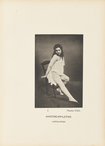 Hystero-epilepsická kontraktura od Paul Marie Léon Regnard