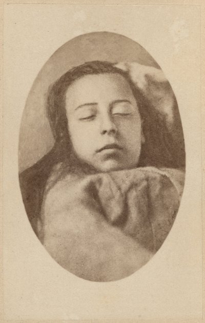 Záchvat hysterie, druhá fáze, ilustrace z "Iconographie Photographique de La Salpetriere" od Bourneville et P. Regnard, deska III, Paříž, 1876 (albumenový tisk) od Paul Regnard