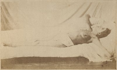 Hysterická epilepsie, útok, ukřižování, deska VI z „Iconographie Photographique de La Salpetriere“ od Bourneville et P. Regnard, Paříž, 1876 (tisk alba) od Paul Regnard