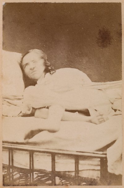 Hysterická epilepsie, křeče, deska XXXVIII z "Iconographie Photographique de La Salpetriere" od Bourneville et P. Regnard, Paříž, 1876 (albumenový tisk) od Paul Regnard
