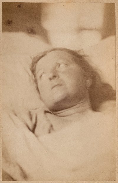 Hysterická epilepsie, ukřižování, postoj hlavy, deska VII z "Iconographie Photographique de La Salpetriere" od Bourneville et P. Regnard, Paříž, 1876 (albumenový tisk) od Paul Regnard