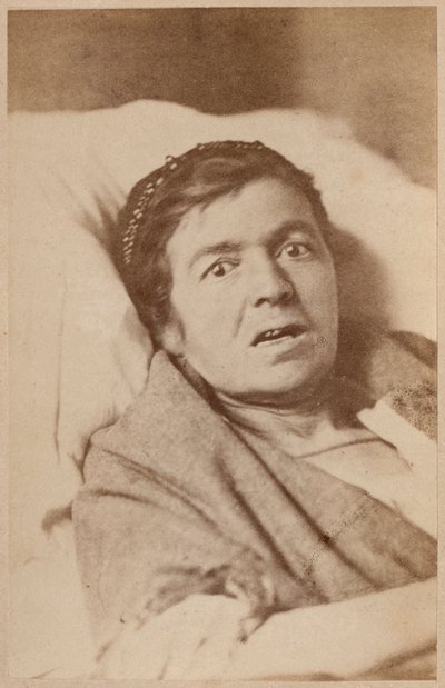 Hysterická epilepsie, kontrakce obličeje, deska VIII z „Iconographie Photographique de La Salpetriere“ od Bourneville a P. Regnarda, Paříž, 1876 (tisk alba) od Paul Regnard