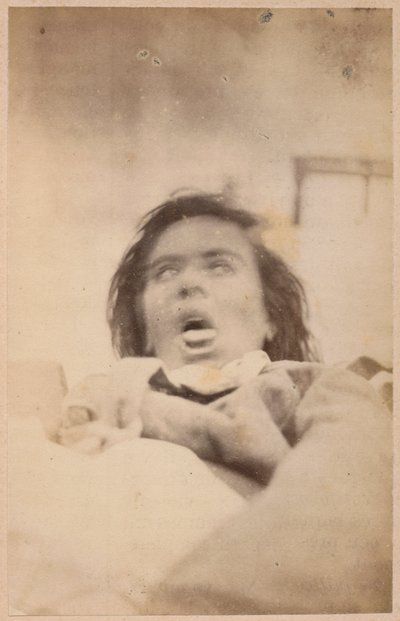 Hysterická epilepsie, halucinace, úzkost, deska XXIX z „Iconographie Photographique de La Salpetriere“ od Bourneville a P. Regnarda, Paříž, 1876 (tisk alba) od Paul Regnard