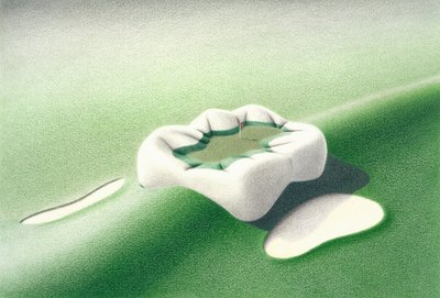 Inlay od Rene Boin