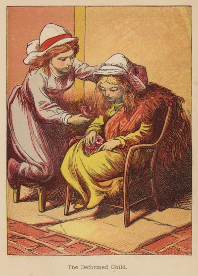 Deformované dítě (kolorovaná rytina) od Thomas Dalziel