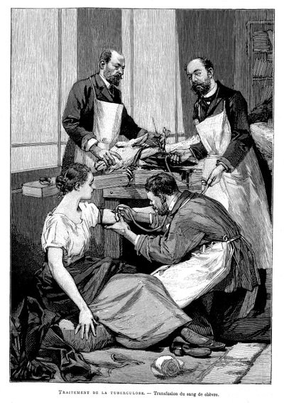 Pacientovi s tuberkulózou byla podána transfuze kozí krve, 1891 od Unbekannt