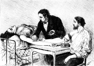 Dr. Roussell ze Ženevy, který dal ženě přímou krevní transfuzi od dobrovolníka, 1882 od Unbekannt