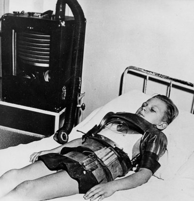 Jedenáctiletý chlapec v železných plicích, nemocnice Beaujon, Paříž, c1947-1951 od Unbekannt