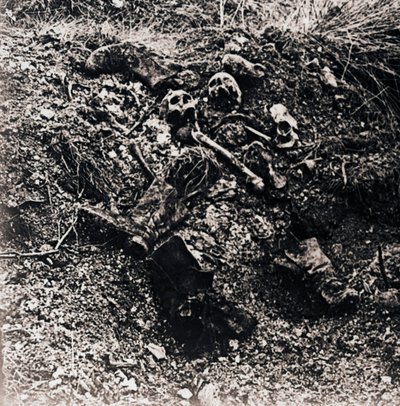 Lidské pozůstatky, c1914-c1918 od Unbekannt