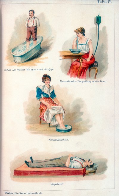 Hydroterapie, c1902 od Unbekannt