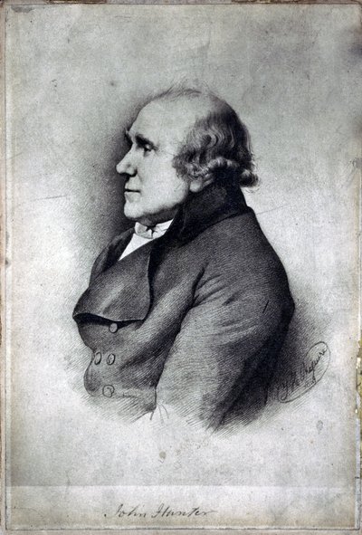 John Hunter, britský chirurg a anatom, c 1770 od Unbekannt