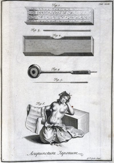 Alternativa medicíny: planche representant les aiguilles d
