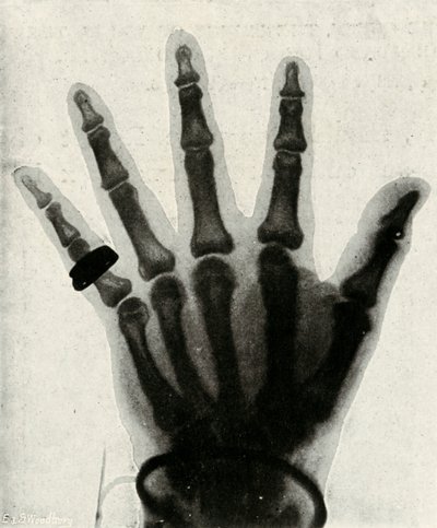 Rentgenový snímek ruky H.R.H. Princ z Walesu, c1897 od Unbekannt