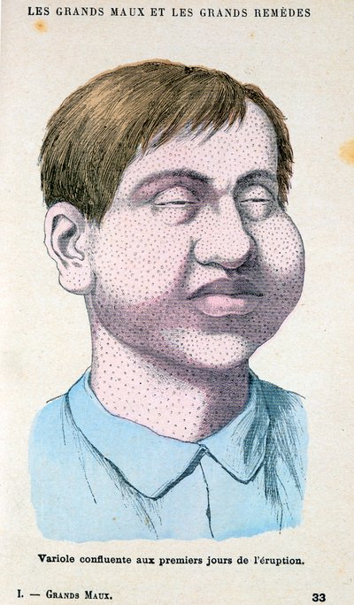 Oběť neštovic, c1890 od Unbekannt