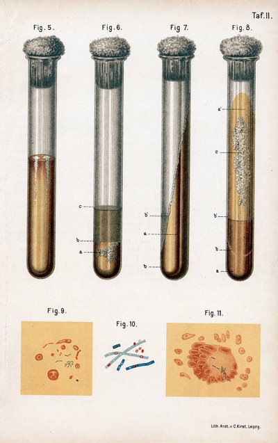 Různé druhy bakterií, 1889 od Unbekannt