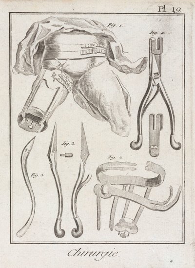 Raná moderní ortopedická chirurgie od Unbekannt