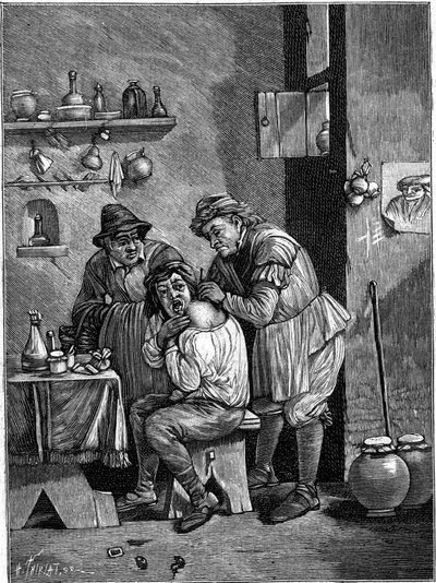 Šarlatánský chirurg v 18. století vyšetřující zranění ramene. (Z rytiny času). Gravírování v „“ La Nature: revue des sciences et de leurs applications aux arts et a l