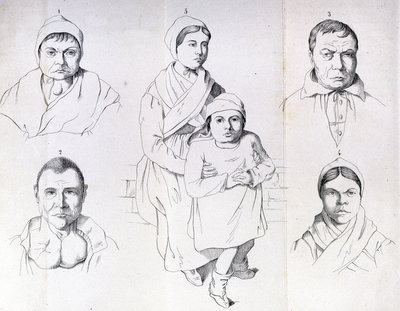 Úvahy o příčinách endemického kretinismu od Morela. od Unknown artist
