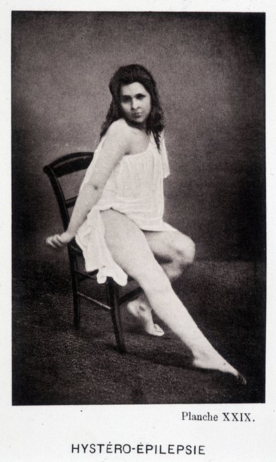 Hystero Epilepsie - Kontraktura v „“ Fotografické ikonografii Salpétrière: služba pana Charcota“ od Paula Regnarda a Bourneville od Unknown artist