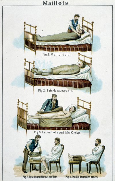 Dresy: 1) Totální dres, 2) Parní lázeň v posteli, 3) Kneippův krátký dres, 4-5) Lýtkový dres – v „Bilz, přírodní léčivo“, konec 19. století od Unknown artist