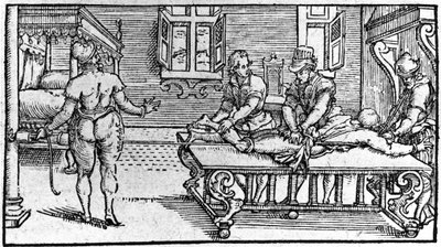 Redukce dislokace, v „Traité Médical“ od Ambroise Paré, kolem roku 1560. od Unknown artist