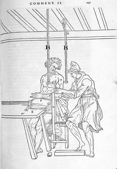 Redukce zlomenin. Deska s vyobrazením „Pitva lidského těla na tři části...“ od Carlo Stefano Riverio, Paříž 1545 od Unknown artist