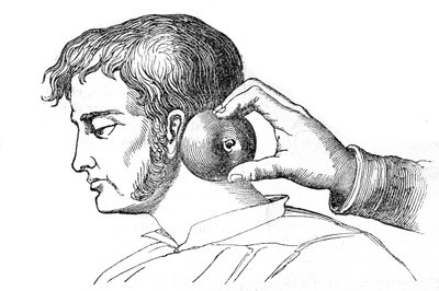 Saignee locales – aplikace pijavic s jablkem – rytina v „La Santo Universelle – Medical Guide for Families““ 1852 od Unknown artist